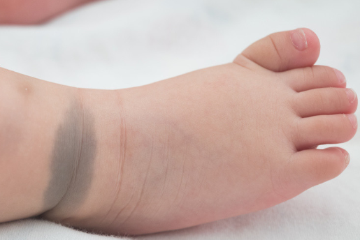 菩萨送的孩子带胎记